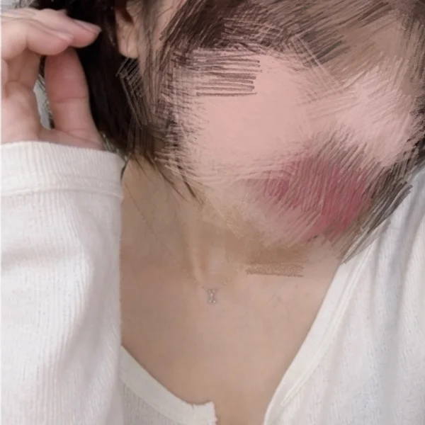 います